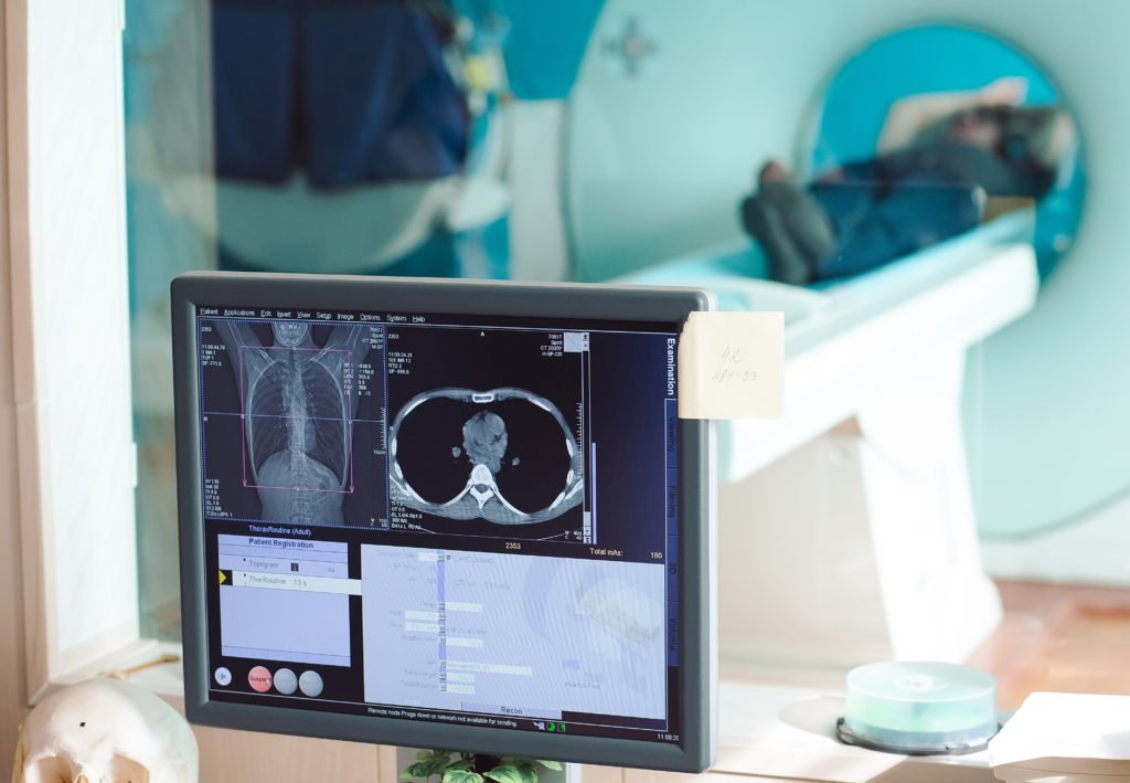 Cancer diagnosis in Turkey